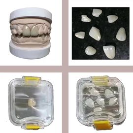 プラスチックの歯科実験室は膜の歯の保持器の箱の総義歯の収納箱に用具を使います